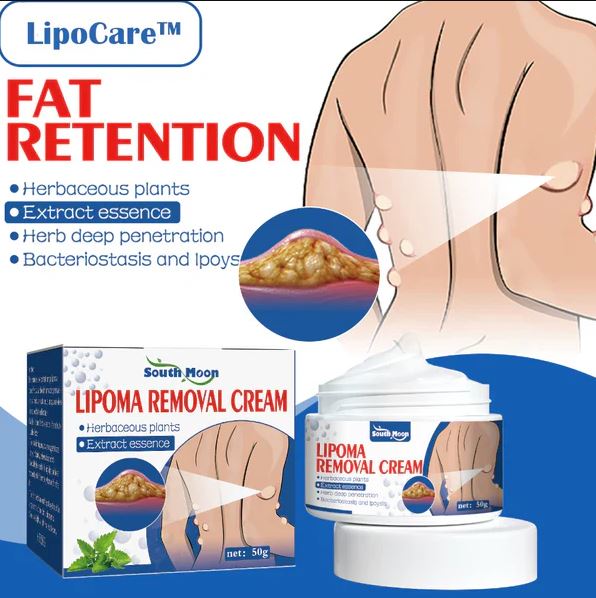 Doctor's No 1 choice | Lipoma Removal Cream (Pack of 2)