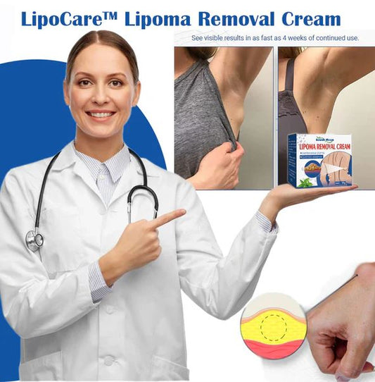 Doctor's No 1 choice | Lipoma Removal Cream (Pack of 1)